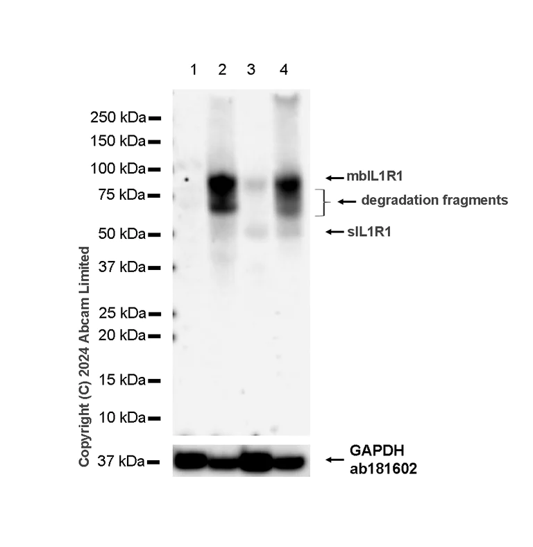 Western blot - Anti-IL1 Receptor I/IL-1R-1 antibody [RM1242] (AB322149)