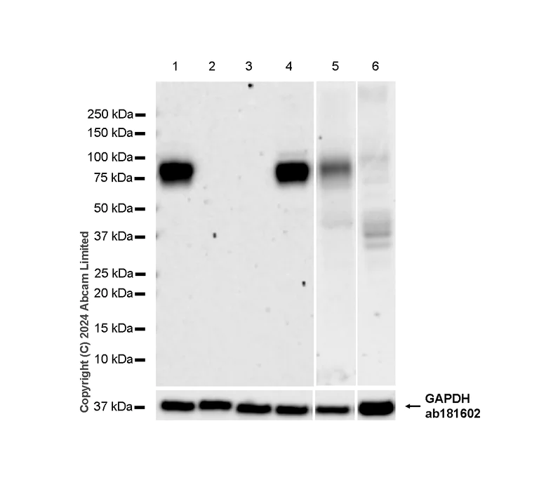 Western blot - Anti-IL1 Receptor I/IL-1R-1 antibody [RM1242] (AB322149)