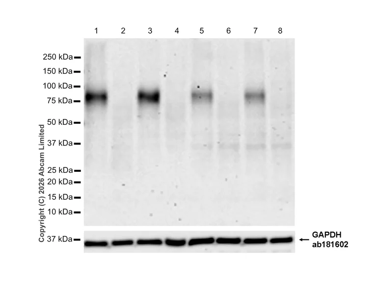 Western blot - Anti-IL1 Receptor I/IL-1R-1 antibody [RM1242] (AB322149)