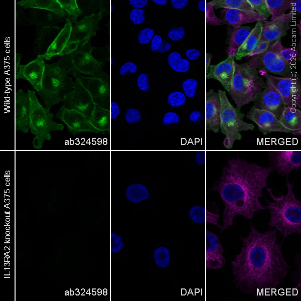 Immunocytochemistry/ Immunofluorescence - Anti-IL13RA2 antibody [RM2087] (AB324598)