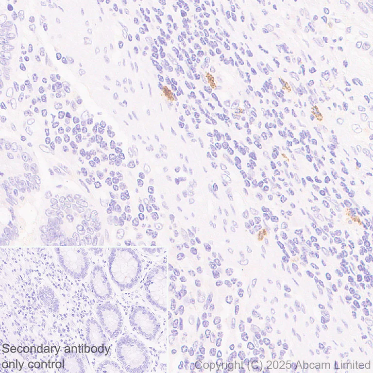 Immunohistochemistry (Formalin/PFA-fixed paraffin-embedded sections) - Anti-IL13RA2 antibody [RM2087] (AB324598)