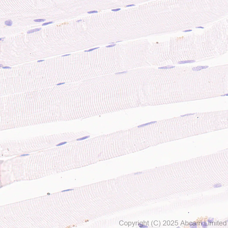 Immunohistochemistry (Formalin/PFA-fixed paraffin-embedded sections) - Anti-IL13RA2 antibody [RM2087] (AB324598)