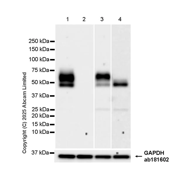 Western blot - Anti-IL13RA2 antibody [RM2087] (AB324598)