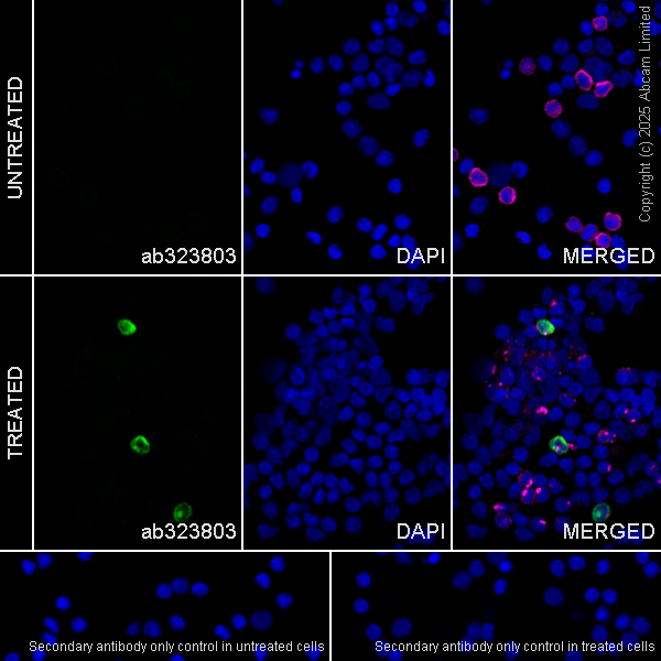 Immunocytochemistry/ Immunofluorescence - Anti-IL17A antibody [EPR19941-88R] (AB323803), expandable thumbnail