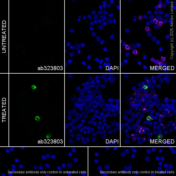 Immunocytochemistry/ Immunofluorescence - Anti-IL17A antibody [EPR19941-88R] (AB323803)
