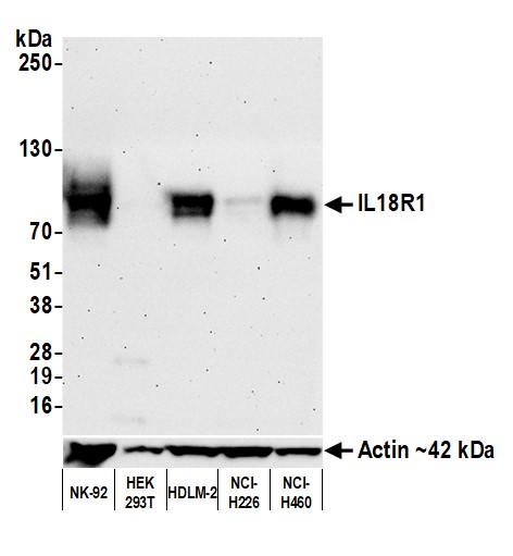 Western blot - Anti-IL18R1 antibody [BLR172J]- BSA free (AB314045), expandable thumbnail