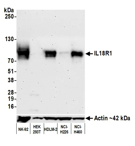 Western blot - Anti-IL18R1 antibody [BLR172J]- BSA free (AB314045)