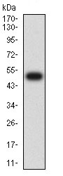 Western blot - Anti-IL2 Receptor beta/p75 antibody [1G11C6] (AB233792), expandable thumbnail