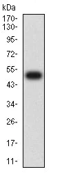 Western blot - Anti-IL2 Receptor beta/p75 antibody [1G11C6] (AB233792)