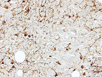 Immunohistochemistry (Formalin/PFA-fixed paraffin-embedded sections) - Anti-IL2 Receptor beta/p75 antibody (AB137699)