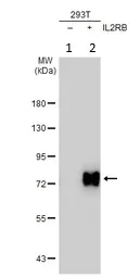 Western blot - Anti-IL2 Receptor beta/p75 antibody (AB137699)