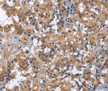 Immunohistochemistry (Formalin/PFA-fixed paraffin-embedded sections) - Anti-IL2 Receptor beta/p75 antibody (AB197934)