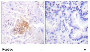 Immunohistochemistry (Formalin/PFA-fixed paraffin-embedded sections) - Anti-IL2 Receptor beta/p75 antibody (AB61195)
