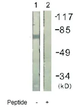 Western blot - Anti-IL2 Receptor beta/p75 antibody (AB61195)