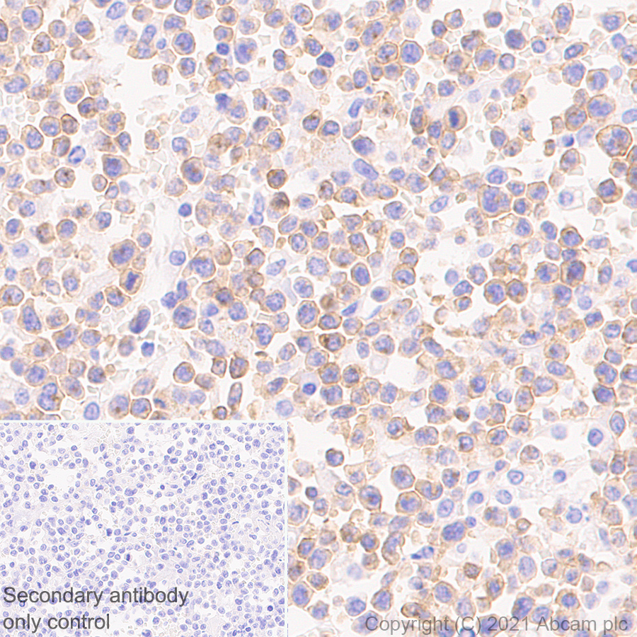 Immunohistochemistry (Formalin/PFA-fixed paraffin-embedded sections) - Anti-IL2 Receptor beta/p75 antibody [EPR24336-29] - BSA and Azide free (ab282283), expandable thumbnail