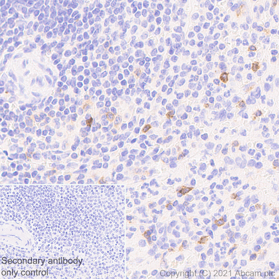 Immunohistochemistry (Formalin/PFA-fixed paraffin-embedded sections) - Anti-IL2 Receptor beta/p75 antibody [EPR24336-29] - BSA and Azide free (AB282283), expandable thumbnail
