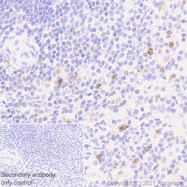 Immunohistochemistry (Formalin/PFA-fixed paraffin-embedded sections) - Anti-IL2 Receptor beta/p75 antibody [EPR24336-29] - BSA and Azide free (AB282283)