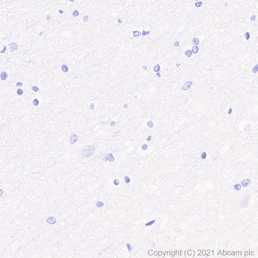 Immunohistochemistry (Formalin/PFA-fixed paraffin-embedded sections) - Anti-IL2 Receptor beta/p75 antibody [EPR24336-29] - BSA and Azide free (AB282283), expandable thumbnail