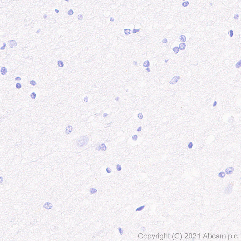 Immunohistochemistry (Formalin/PFA-fixed paraffin-embedded sections) - Anti-IL2 Receptor beta/p75 antibody [EPR24336-29] - BSA and Azide free (AB282283)