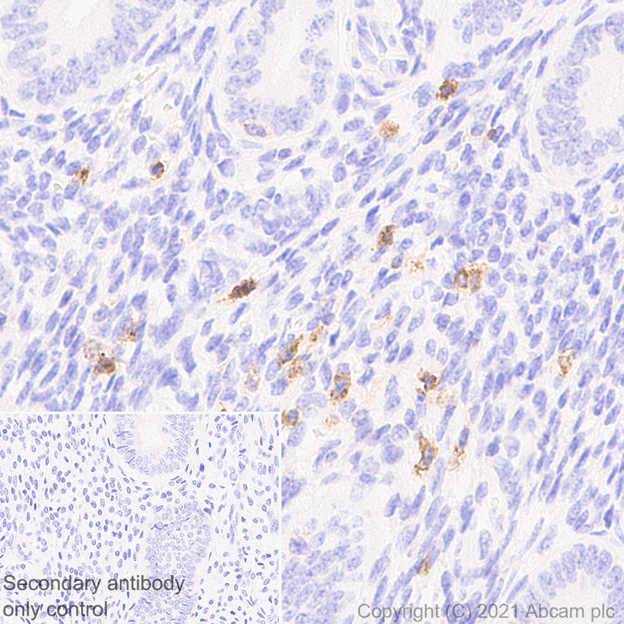 Immunohistochemistry (Formalin/PFA-fixed paraffin-embedded sections) - Anti-IL2 Receptor beta/p75 antibody [EPR24336-29] - BSA and Azide free (ab282283), expandable thumbnail