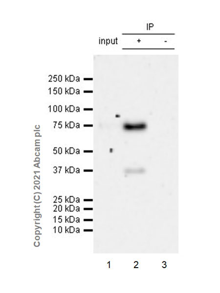 Immunoprecipitation - Anti-IL2 Receptor beta/p75 antibody [EPR24336-29] - BSA and Azide free (AB282283), expandable thumbnail