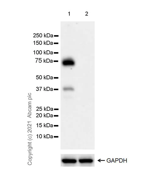 Western blot - Anti-IL2 Receptor beta/p75 antibody [EPR24336-29] - BSA and Azide free (AB282283)