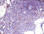 Immunohistochemistry (Formalin/PFA-fixed paraffin-embedded sections) - Anti-IL22 RA2/IL-22BP antibody (AB18566)