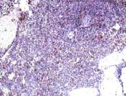 Immunohistochemistry (Formalin/PFA-fixed paraffin-embedded sections) - Anti-IL22 RA2/IL-22BP antibody (AB18566)