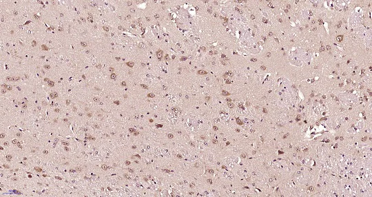 Immunohistochemistry (Formalin/PFA-fixed paraffin-embedded sections) - Anti-IL22 RA2/IL-22BP antibody (AB203211)