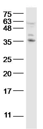 Western blot - Anti-IL22 RA2/IL-22BP antibody (AB203211)