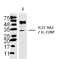 Western blot - Anti-IL22 RA2/IL-22BP antibody (AB203211)
