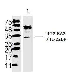 Western blot - Anti-IL22 RA2/IL-22BP antibody (AB203211)