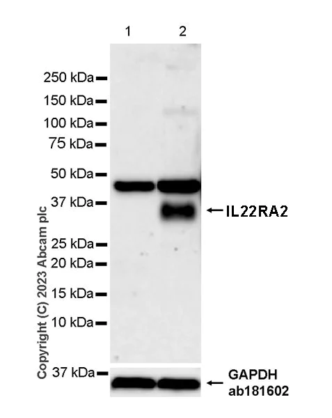 Western blot - Anti-IL22 RA2/IL-22BP antibody [EPR25046-231] (AB314887)