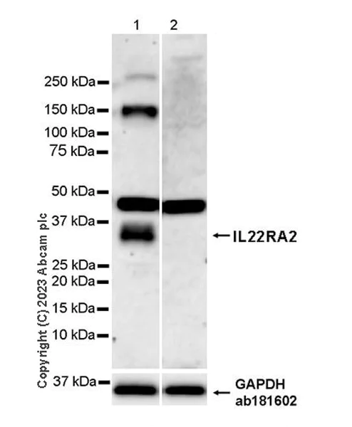 Western blot - Anti-IL22 RA2/IL-22BP antibody [EPR25046-231] (AB314887)