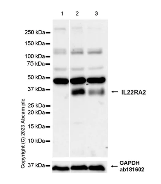 Western blot - Anti-IL22 RA2/IL-22BP antibody [EPR25046-231] (AB314887)