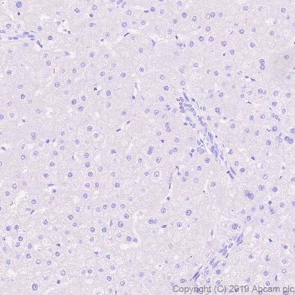 Immunohistochemistry (Formalin/PFA-fixed paraffin-embedded sections) - Anti-IL22 RA2/IL-22BP antibody [EPRR23006-70] (AB267467)