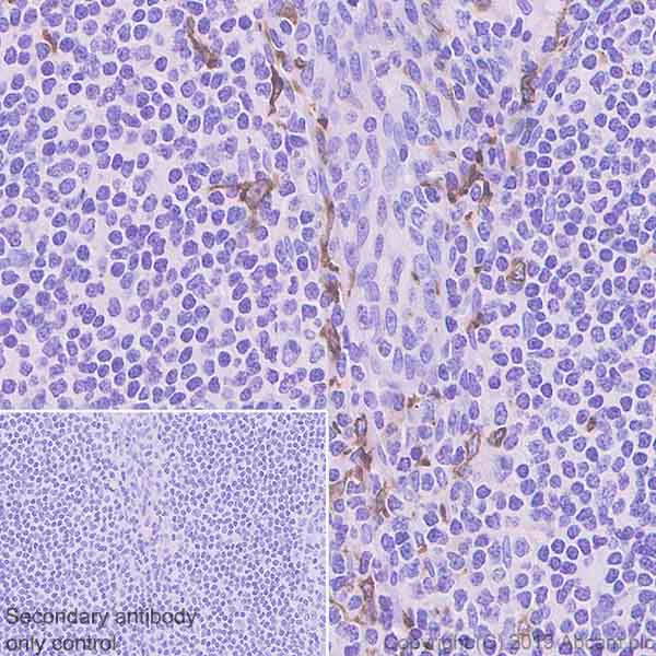 Immunohistochemistry (Formalin/PFA-fixed paraffin-embedded sections) - Anti-IL22 RA2/IL-22BP antibody [EPRR23006-70] (AB267467)