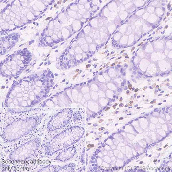 Immunohistochemistry (Formalin/PFA-fixed paraffin-embedded sections) - Anti-IL22 RA2/IL-22BP antibody [EPRR23006-70] - BSA and Azide free (AB267789)