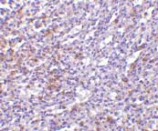 Immunohistochemistry (Formalin/PFA-fixed paraffin-embedded sections) - Anti-IL27RA/WSX-1 antibody (AB5997)