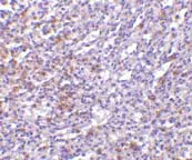 Immunohistochemistry (Formalin/PFA-fixed paraffin-embedded sections) - Anti-IL27RA/WSX-1 antibody (AB5997)