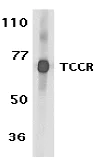 Western blot - Anti-IL27RA/WSX-1 antibody (AB5997)