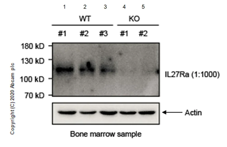 Western blot - Anti-IL27RA/WSX-1 antibody [EPR20863-3] (AB220359)