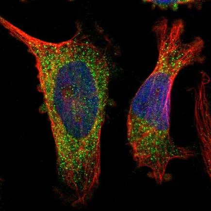 Immunocytochemistry/ Immunofluorescence - Anti-IL28RA antibody (AB224395)