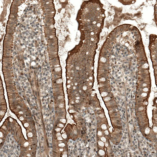 Immunohistochemistry (Formalin/PFA-fixed paraffin-embedded sections) - Anti-IL28RA antibody (AB224395)