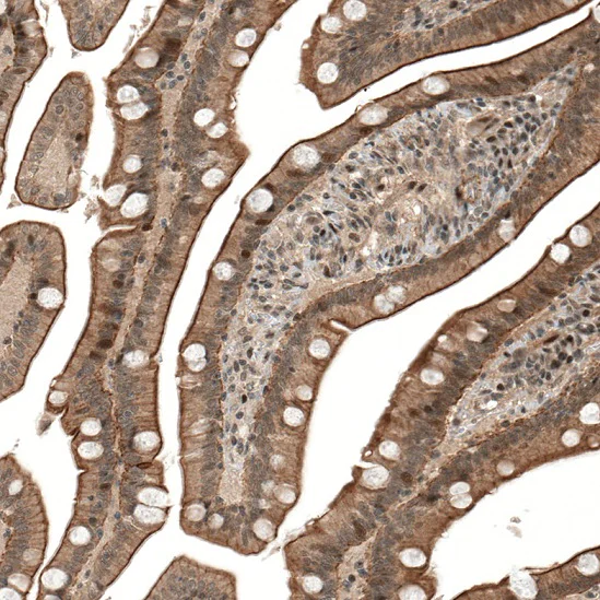 Immunohistochemistry (Formalin/PFA-fixed paraffin-embedded sections) - Anti-IL28RA antibody (AB224395)