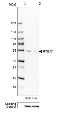 Western blot - Anti-IL28RA antibody (AB224395)