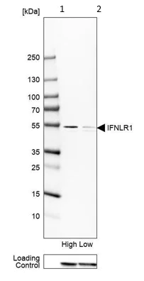 Western blot - Anti-IL28RA antibody (AB224395)