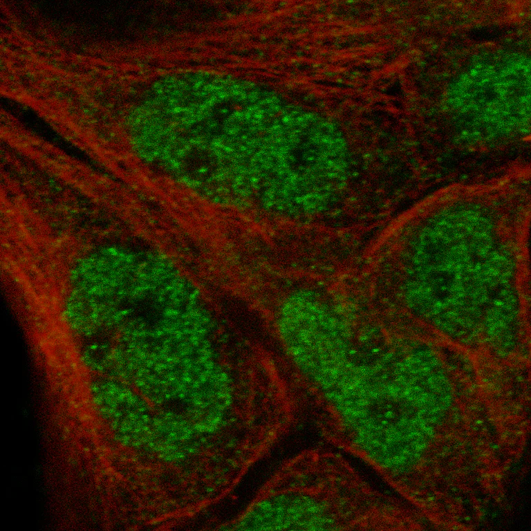 Immunocytochemistry/ Immunofluorescence - Anti-IL33 Antibody [CL13438] (AB327145)