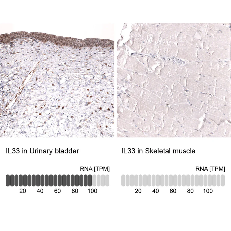 Immunohistochemistry (Formalin/PFA-fixed paraffin-embedded sections) - Anti-IL33 Antibody [CL13438] (AB327145)
