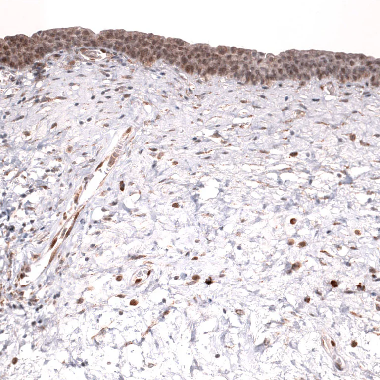 Immunohistochemistry (Formalin/PFA-fixed paraffin-embedded sections) - Anti-IL33 Antibody [CL13438] (AB327145)